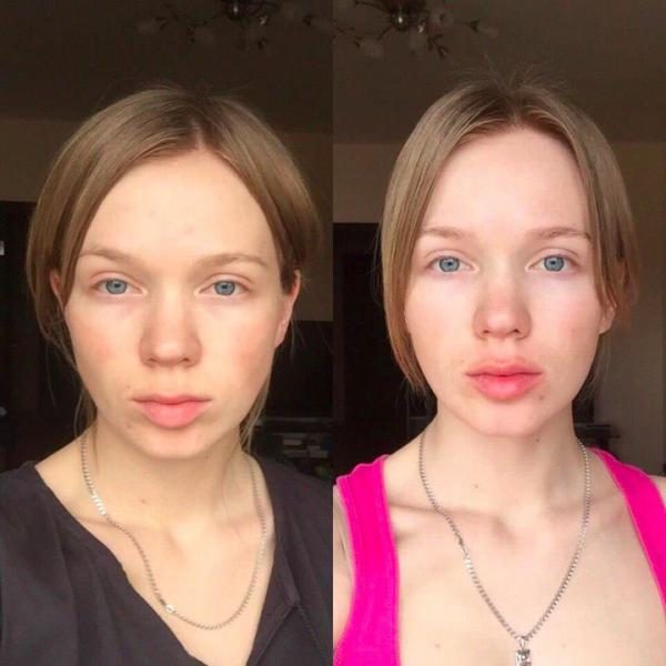 Гимнастика для молодости кожи лица