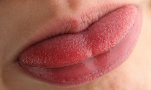 10 удивительных фактов про человеческий рот 10 удивительных фактов про человеческий рот